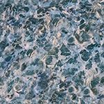 foam